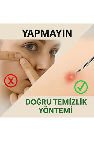 poswicon Siyah Nokta Temizleyici 4'lü Set Kutulu Paslanmaz Çelik Akne Iğne Çı...