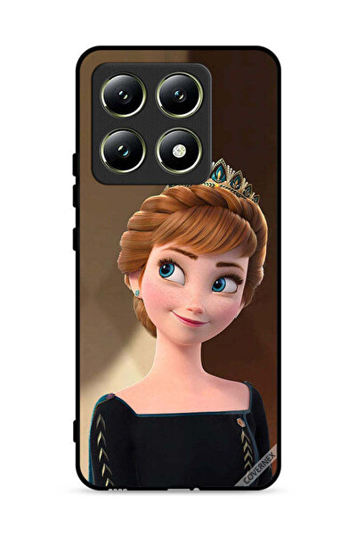 Covernex غطاء حماية لهاتف شاومي 14T 5G فروزن آنا