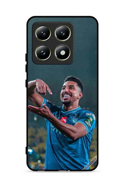 Covernex غطاء حماية لهاتف شاومي 14T 5G من سالم الدوسري