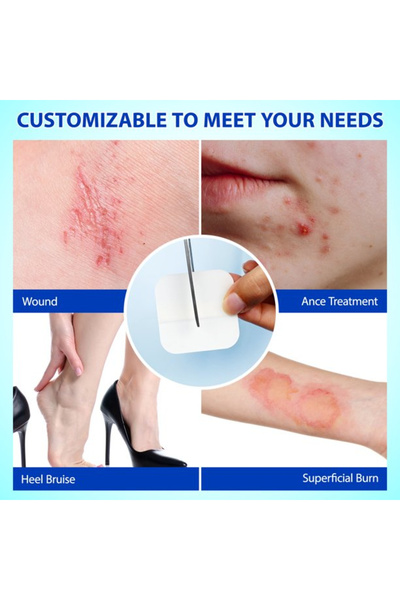 NOVA KISS Professional Hydrocolloid Plasters for Scars, Burns, Wounds, Sterile, 10 pcs, 5 cm x 10 cm