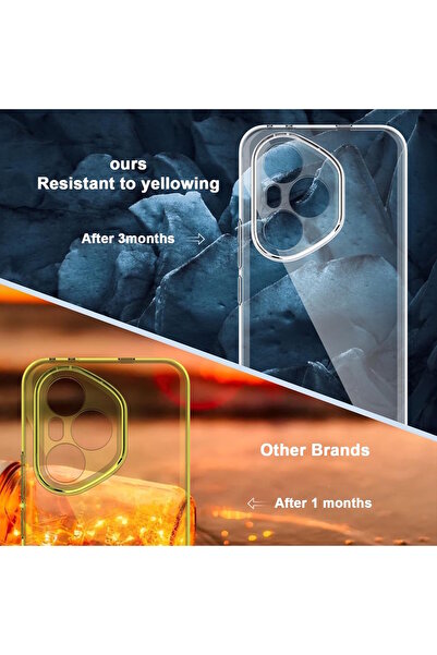 m.tk moveteck Honor 400 Pro Kılıf Kamera Çıkıntılı Korumalı Yumuşak Şeffaf Silikon + 5D Ekran Koruyucu Cam Set 1er