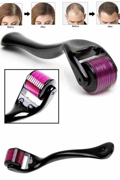 Clevora Derma Roller Titanium Tip 540 Needle 1 mm Hair and Skin Care Massage Tool