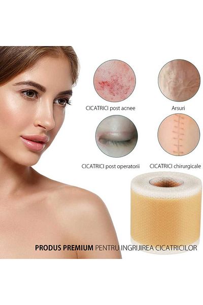 NOVA KISS Rolă medicală premium din silicon pentru îngrijirea cicatricilor, reutilizabilă, NOVA KISS®, 4 cm x 3 m