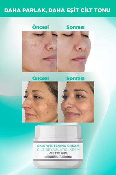 LAST TOUCH Cilt Beyazlatıcı Krem, Leke ve Renk Tonu Eşitsizliği Karşıtı, Alpha Arbutin ve Vitamin C 100 ML