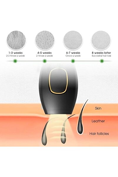 SUKILO IPL Hair Removal Device ZP575 | 5 Energy Levels | 500,000 Flashes | 3 Modes | Painless Laser