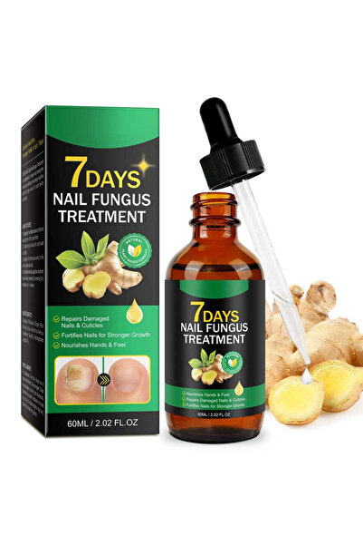 NOVA KISS Tratament antifungic cu ghimbir, stimulează creșterea unghiilor, 60 ml