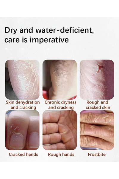 ZHENXIU Horse Oil Moisturizing Cream, Daily Moisturizer for Hand & Feet, Delicates & Smooths Dry Skins, 50g