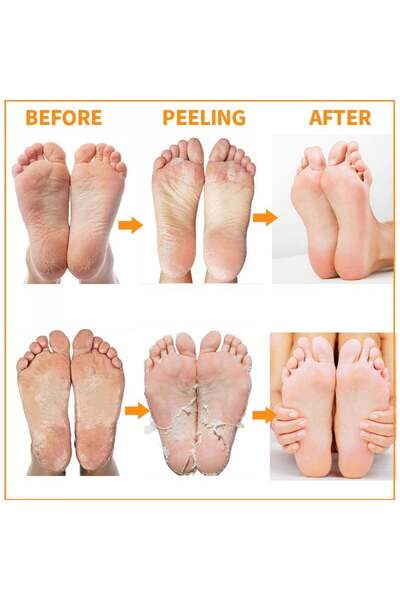 MBeauty Magic Socks 20 Minutes Intensive Foot Peeling 18g 1 Piece Only