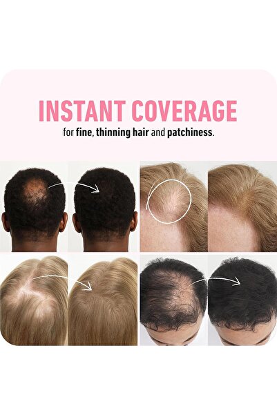 Boldify Saç Dolgunlaştırıcı Kapatıcı Fiber Toz Açık Kahverengi 12GR