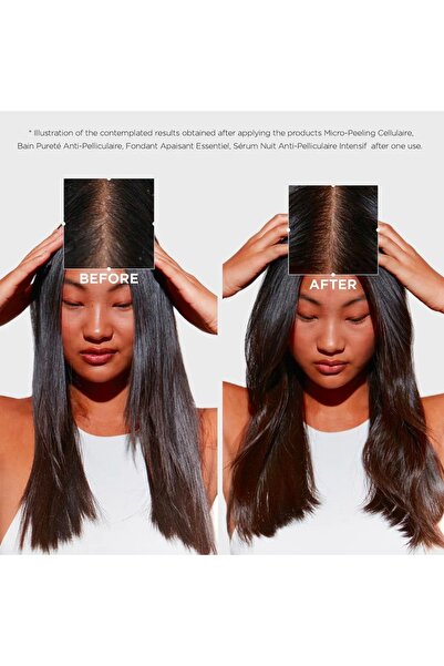 Kerastase Kérastase Symbiose Bain Pureté Anti-Pelliculaire Dandruff Shampoo 250ml – Purifying Scalp Care