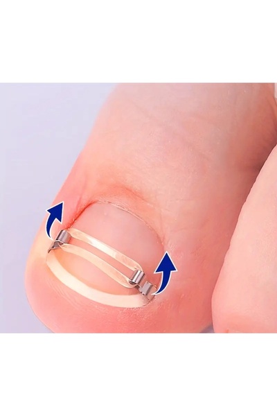 AirOpen Batik Tirnak Düzeltme kiti