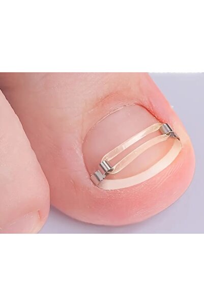 AirOpen Batik Tirnak Düzeltme kiti