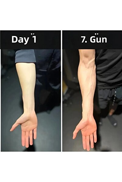 Fontenay Întăritor pentru încheietura mâinii și brațul pentru vene, negru