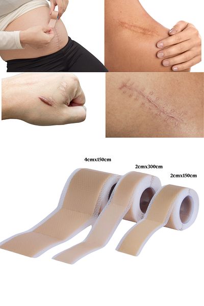 WELLTAPE شريط سيليكون ناعم - مزيل الندبات الجراحية - العملية القيصرية - الحروق - الجمالية 2 سم × 1.5 متر