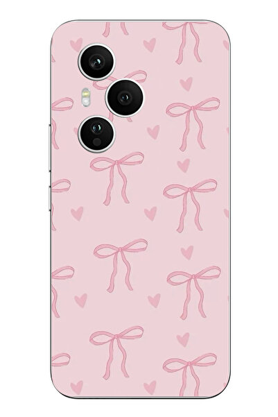 TechTree Honor 400 PRO Uyumlu Pembe Kalpli Fiyonklar Şeffaf Silikon Kılıf