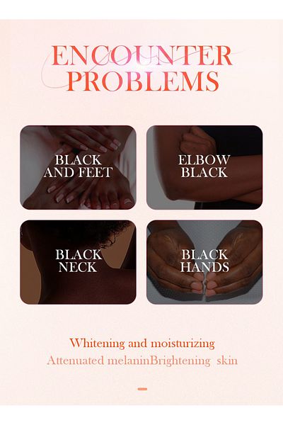 SADOER Dark Knuckle Whitening Serum, Dark Knuckle Whitening Serum for Feet & Elbow & Neck & Hands 50ml