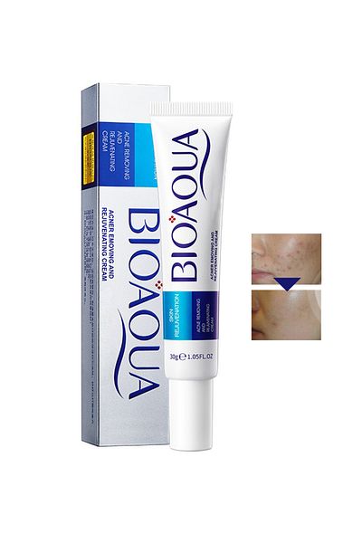 bioaoua Acne Rejuvenation and Cream, Anti-acne Facial Cream, Control Water-Oil Balance & Reduce Redness, 30g