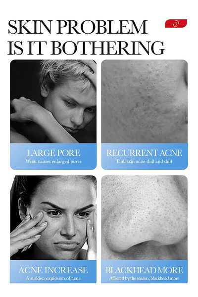 bioaoua Salicylic Acid Acne Removal Cream, Repairing Facial Cream to Reduce Pimples, Relieve Redness, 20g