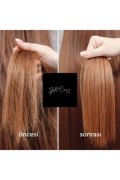 SplitCare PRO Splitcarepro Hair Trimmer ™️   Hair Breakage Removal Machine, Hair Breakage Removal Device