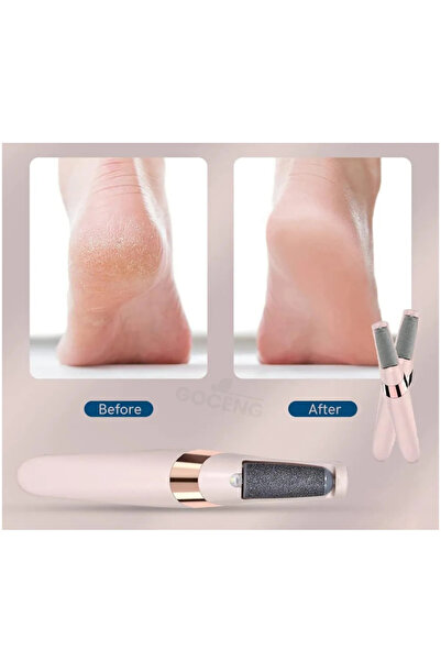 CNGZSHOP Şarjlı Ayak Tabanı Bakım Törpüsü Elektrikli Topuk Temizleme Makinası Nasır Sökücü