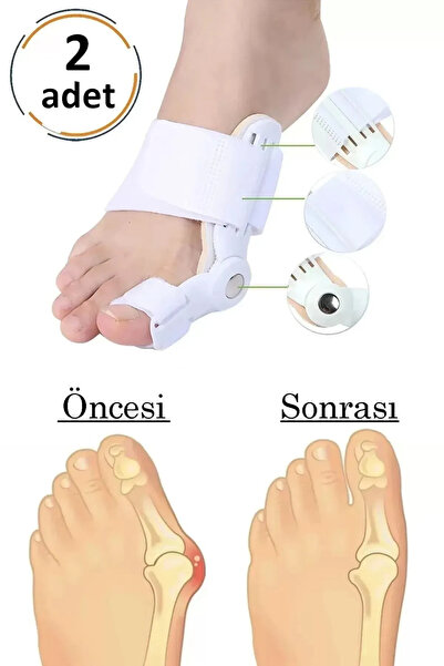 mucit home Atel Ayak Parmak Başparmak Düzeltici Kemik Çıkığı Düzleştirici Taraklı Ayaklar Için Apar