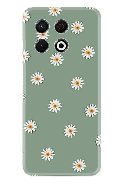 TECNO Spark 30 Pro Kılıf Boutique Baskılı Resimli Yeşil Papatyalar Pcode -041