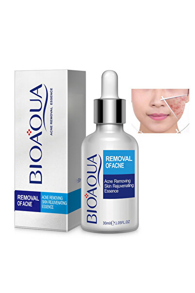bioaoua جوهر تجديد البشرة لإزالة حب الشباب، سيروم للوجه، للتحكم في توازن الما...