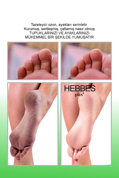 HEBBES Ayak Ve Topuk Çatlak Bakım Kremi, Parmak Arası Mantar, Manikür Pedikür 250ml