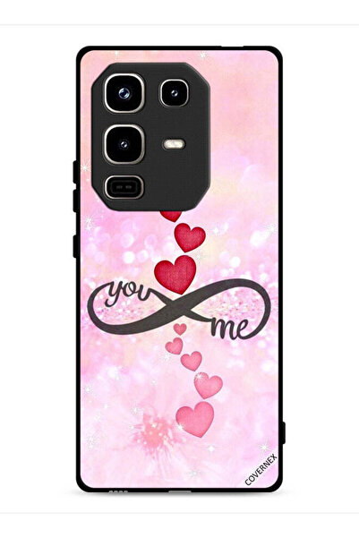 Covernex غطاء حماية لهاتف Infinix Note 50 Pro 4G بتصميم "أنت وأنا"