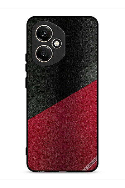 Covernex غطاء حماية جلدي بنقشة لهاتف Honor 400