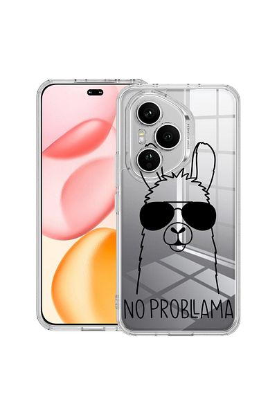 bestcase Carcasă transparentă din silicon pentru Honor 400 Pro, fără probleme LLama, 2036424 T 1819