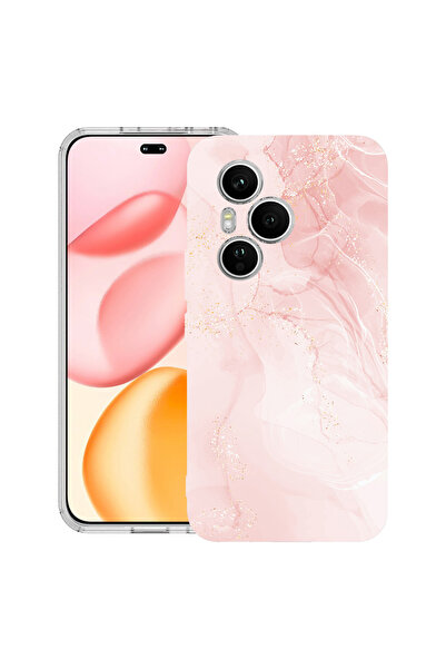 bestcase Carcasă transparentă din silicon pentru Honor 400 Pro, roz pastel, m...