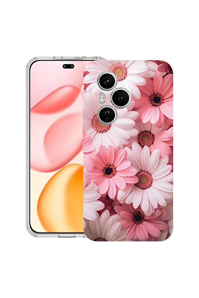bestcase Carcasă transparentă din silicon pentru Honor 400 Pro, roz margaretă...