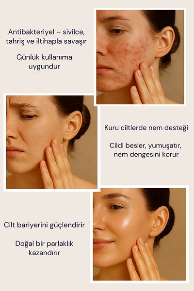 EDLIKE Natural Honey & Propolis Skin Care Soap