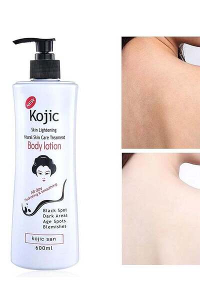 Kojie San لوشن الجسم لتفتيح البشرة والعناية بها طبيعيًا من كوجي سان، 600 مل