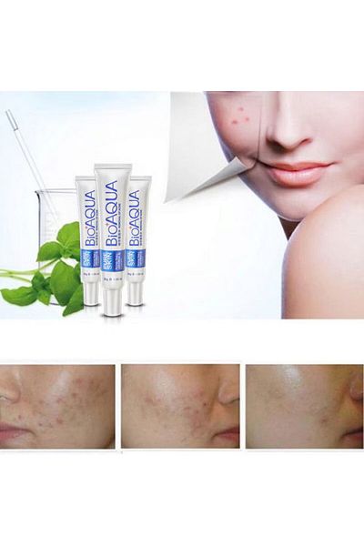 Bioaqua Professional Cream Anti-Acne Face Care Treatment, 30g