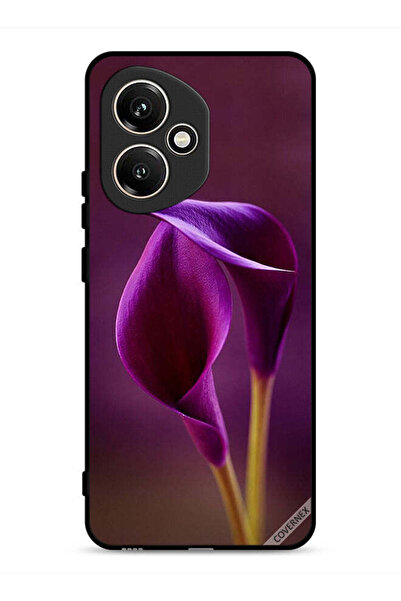 Covernex غطاء حماية لهاتف Honor 400 بزهرتين جميلتين