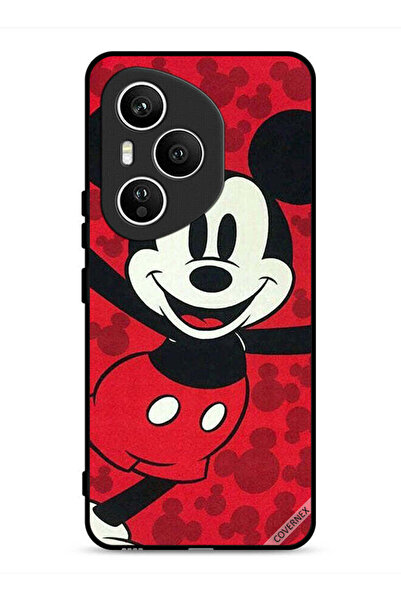 Covernex غطاء حماية لهاتف Honor 400 Pro ميكي ماوس سعيد