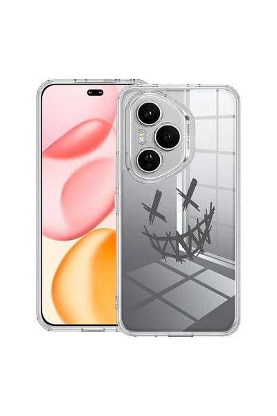 bestcase Carcasă transparentă din silicon pentru Honor 400 Pro, Zâmbește, te rog, 2036424 T 1471
