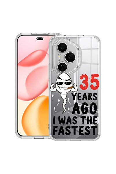 bestcase Carcasă transparentă din silicon pentru Honor 400 Pro, acum 35 de an...