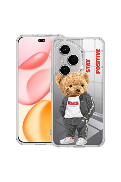 bestcase Carcasă transparentă din silicon pentru Honor 400 Pro, Stay Positive...