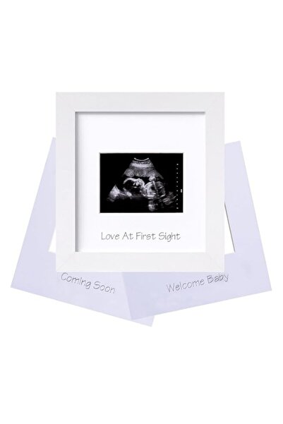 Generic إطار صورة الموجات فوق الصوتية من إليتيك برو، عرض صور الموجات فوق الصو...