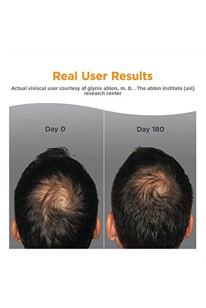 viviscal Hair Growth Supplement for Men | Iron, Marine Collagen & Vitamin C | 60 Tablets