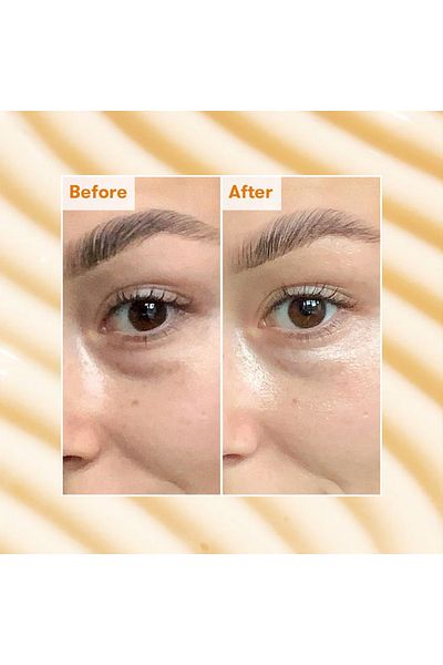 REN CLEAN SKINCARE Radiance Brightening Dark Circle Eye Cream - Eye Cream 15 ml