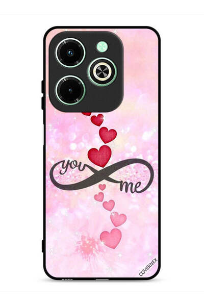 Covernex غطاء حماية لهاتف Infinix Hot 40i 4G بتصميم "أنت وأنا"