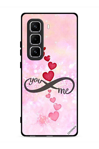 Covernex غطاء حماية لهاتف Infinix Hot 50 Pro 4G بتصميم "أنت وأنا"