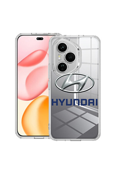 bestcase Carcasă transparentă din silicon pentru Honor 400 Pro, Hyundai, 2036...