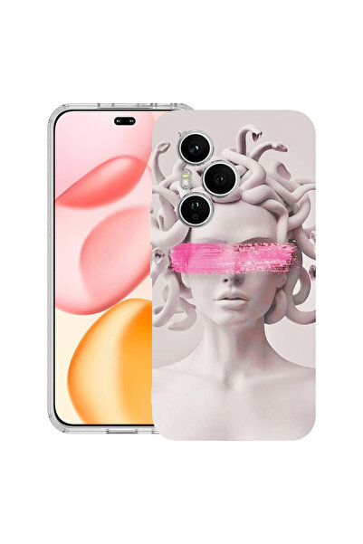 bestcase Carcasă transparentă din silicon pentru Honor 400 Pro, Medusa, 2036424 T 1289
