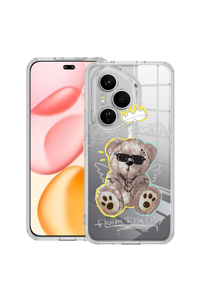 bestcase Carcasă transparentă din silicon pentru Honor 400 Pro, Teddy Bear Ke...