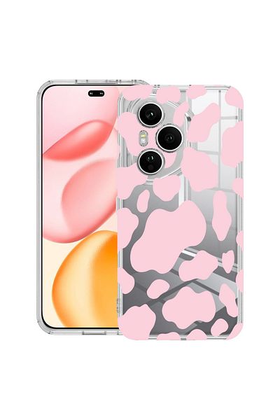 bestcase Carcasă transparentă din silicon pentru Honor 400 Pro, roz vacă, 2036424 T 786